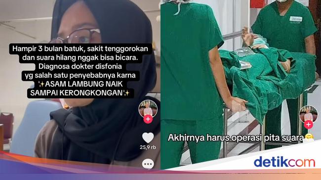 3 Bulan Batuk Tak Sembuh-Berujung Operasi, Ternyata Wanita Ini Kena Disfonia gegara GERD