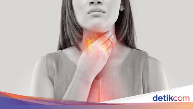 Agar Asam Lambung Tak Kambuh Pas Lebaran, Hindari Sederet Makanan Ini