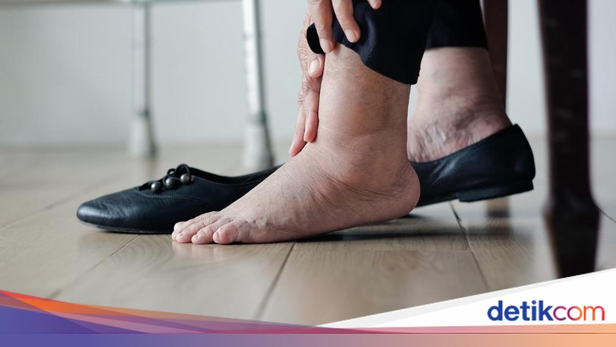 5 Tanda Awal Kanker Paru yang Muncul di Kaki