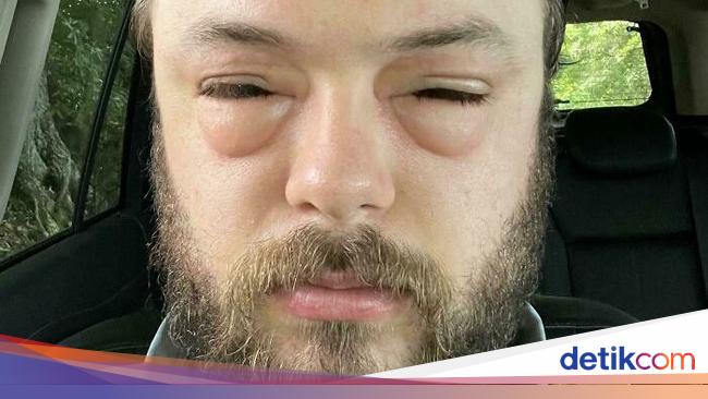 Kumpulan Foto yang Gambarkan Hari Sial Seseorang, Kasihan...