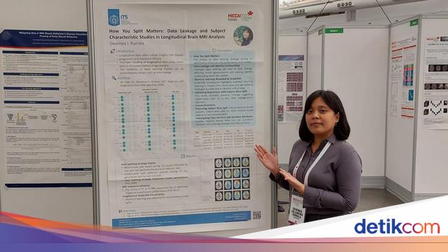 Terobosan AI dari ITS: Membaca MRI Lebih Akurat dari Dokter, Revolusi Diagnosis Otak!