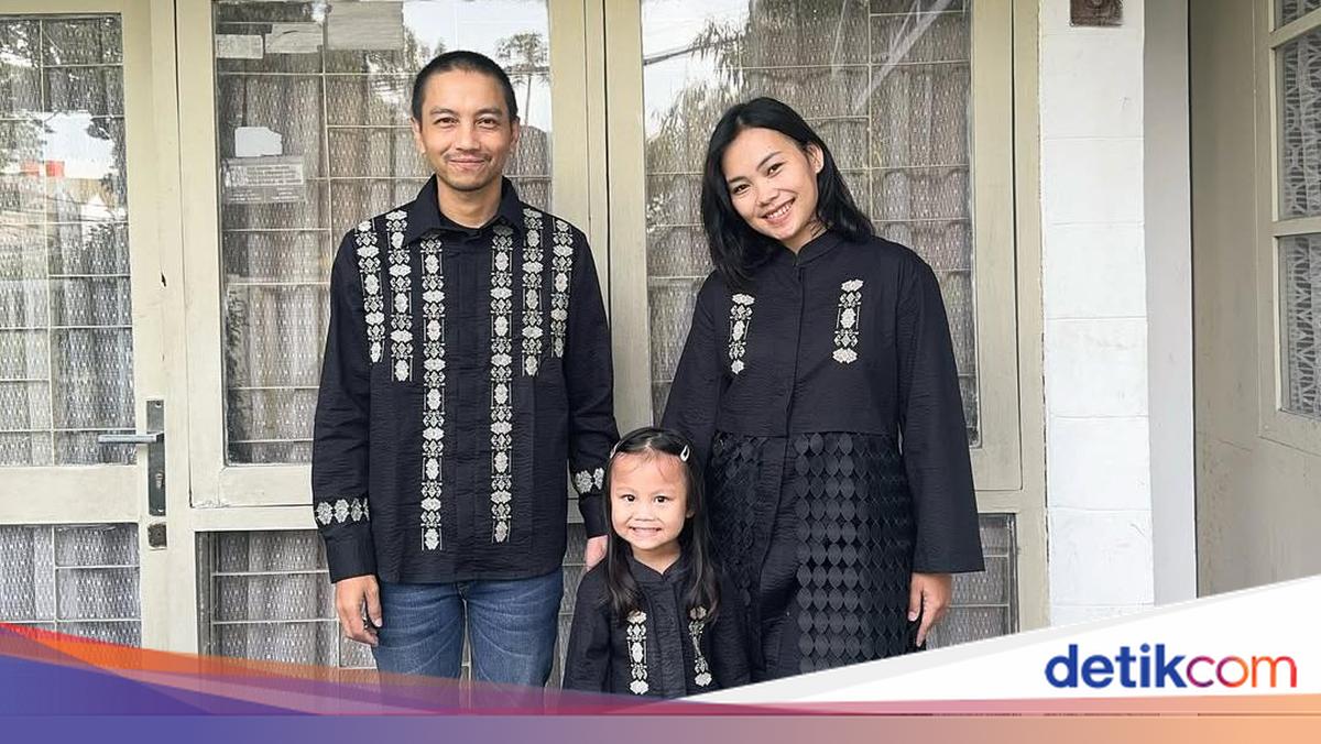 Kondisi Kaki Istri Fiersa Besari Imbas Ditabrak Mobil