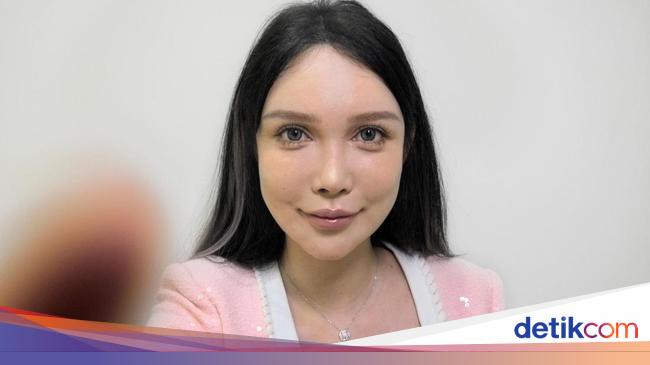 Kisah Perempuan China Sudah 100 Kali Operasi Plastik