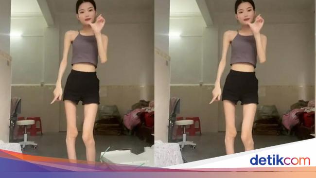 Tren Diet 'SkinnyTok' di TikTok Bisa Sebabkan Gangguan Makan!