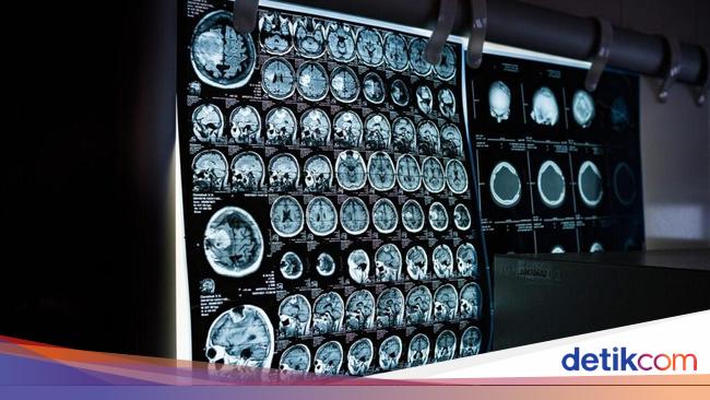 Puasa Bisa Mengubah Otak Manusia, Kok Bisa?