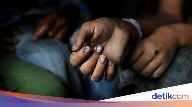 PBB: Pemangkasan Bantuan Hambat Kemajuan Pembangunan Dunia