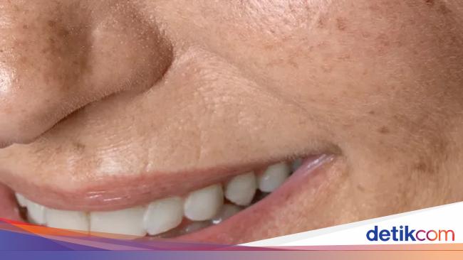 10 Tanda Kamu Mulai Menua, Semuanya Wajar