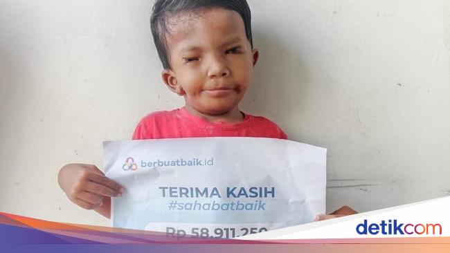Dibantu Sahabat Baik, Kondisi Afriliam Membaik Usai Operasi Langit-langit Mulut
