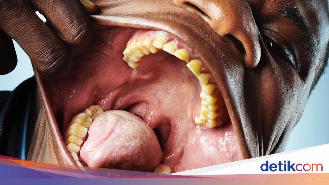10 Orang dengan Tubuh yang Luar Biasa Unik