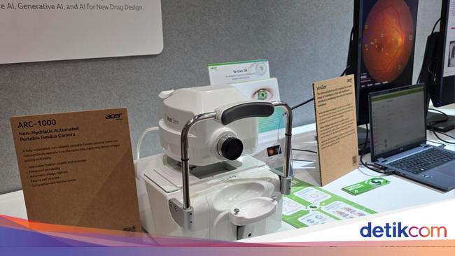 Pakai AI, Acer VeriSee Deteksi Tanda Diabetes dengan Akurasi 93%
