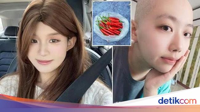 Tragis! Kisah Influencer Tewas karena Terlalu Sering Makan Pedas