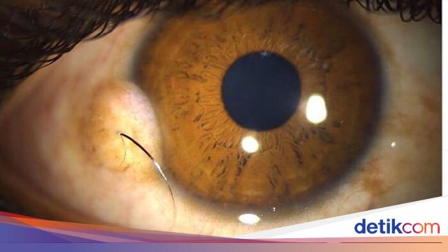 Kondisi Tubuh Manusia Ini Bikin Takjub dan Merinding