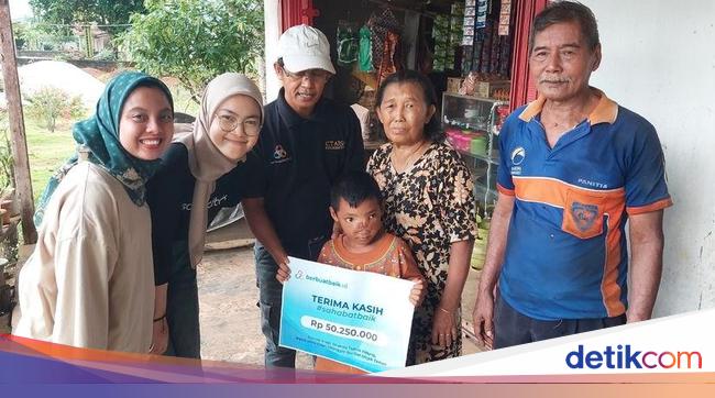 Sahabat Baik Bantu Sukseskan Operasi Tumor Hidung Dilan