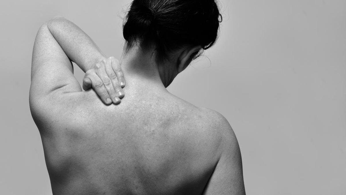 Stop Kaitkan Penyakit Kulit dengan Azab! Dokter Tegaskan Tak Ada Hubungannya