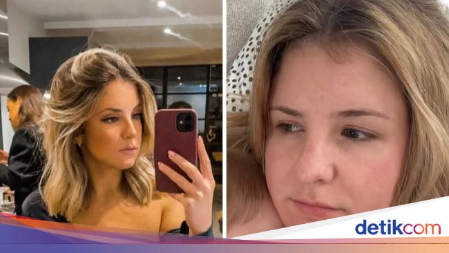 Bukan Glow Up, Orang-orang Ini Justru Merasa Makin Glow Down