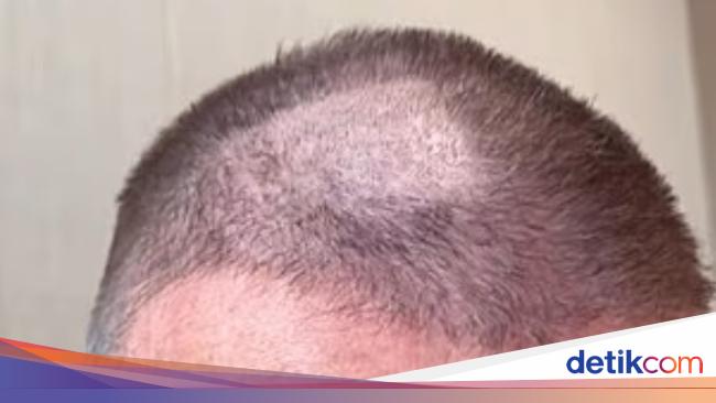 Salah Potong Rambut, David Beckham jadi Pitak