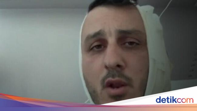 Liburan di Yunani, Telinga Turis Israel Robek Digigit Orang