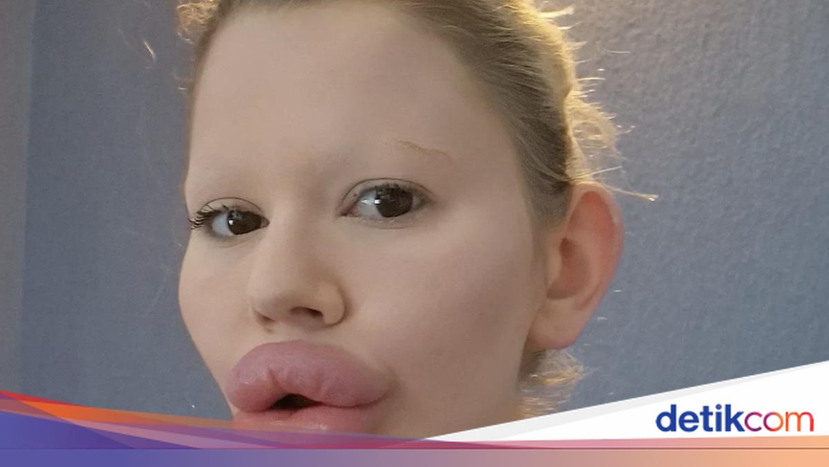 Anal jinsiy aloqa forum vbulletin