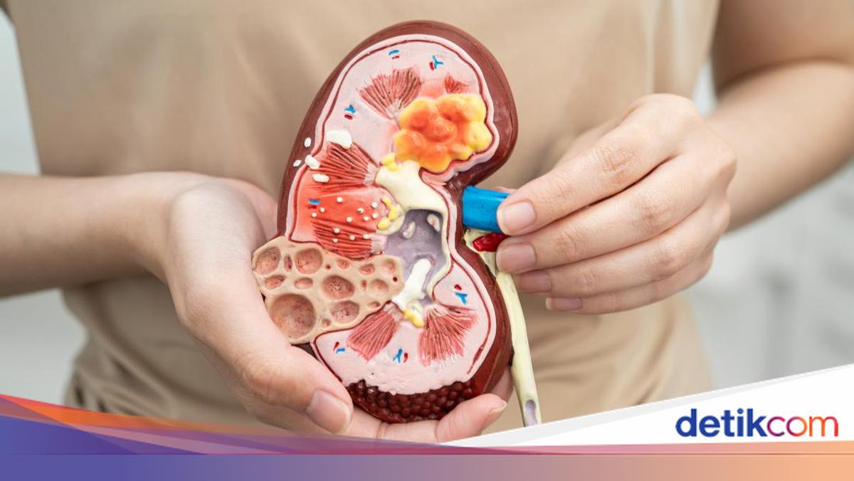 Gejala Penyakit Ginjal Terlambat Terlihat: Ini Alasan Medis yang Perlu Anda Ketahui