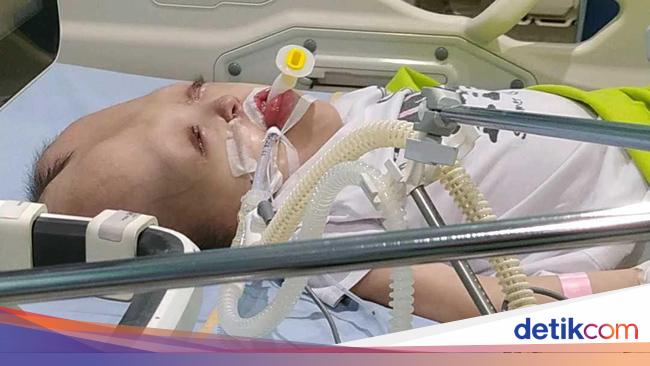 Kisah Dhafita yang Berjuang Lawan Hidrosefalus, Epilepsi hingga Cerebral Palsy
