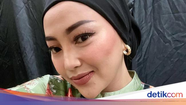 Rahasia di Balik Mpok Alpa Siapkan Wig Dalih Rambut Rontok Usai Lahiran
