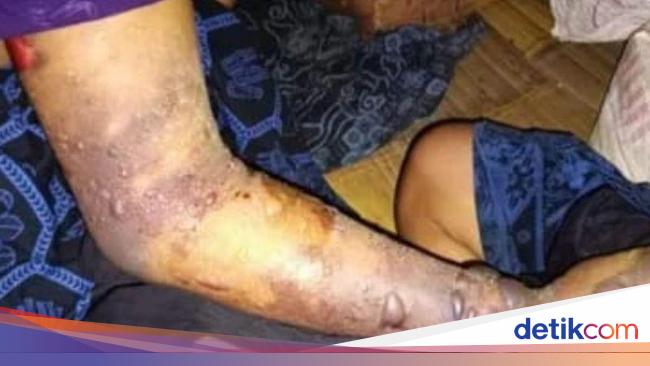 7 Warga Suku Baduy Tewas Akibat Gigitan Ular Tanah, Terlambat Dibawa ke RS