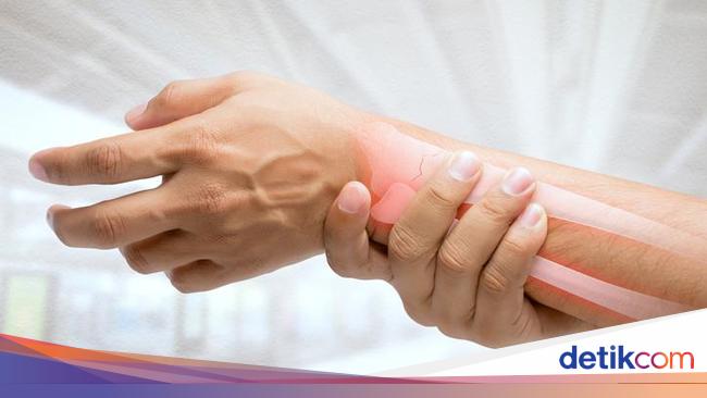 7 Makanan yang Bikin Tulang Keropos, Batasi Konsumsinya