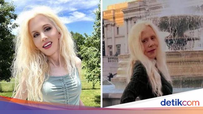 Foto Editan Medsos Kebablasan, Bikin Kaget dan Geleng-geleng