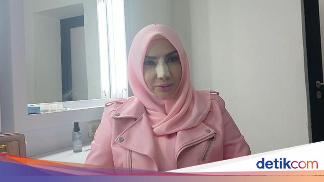 Alasan Roro Fitria Jalani Operasi Sinus Sekaligus Rhinoplasty