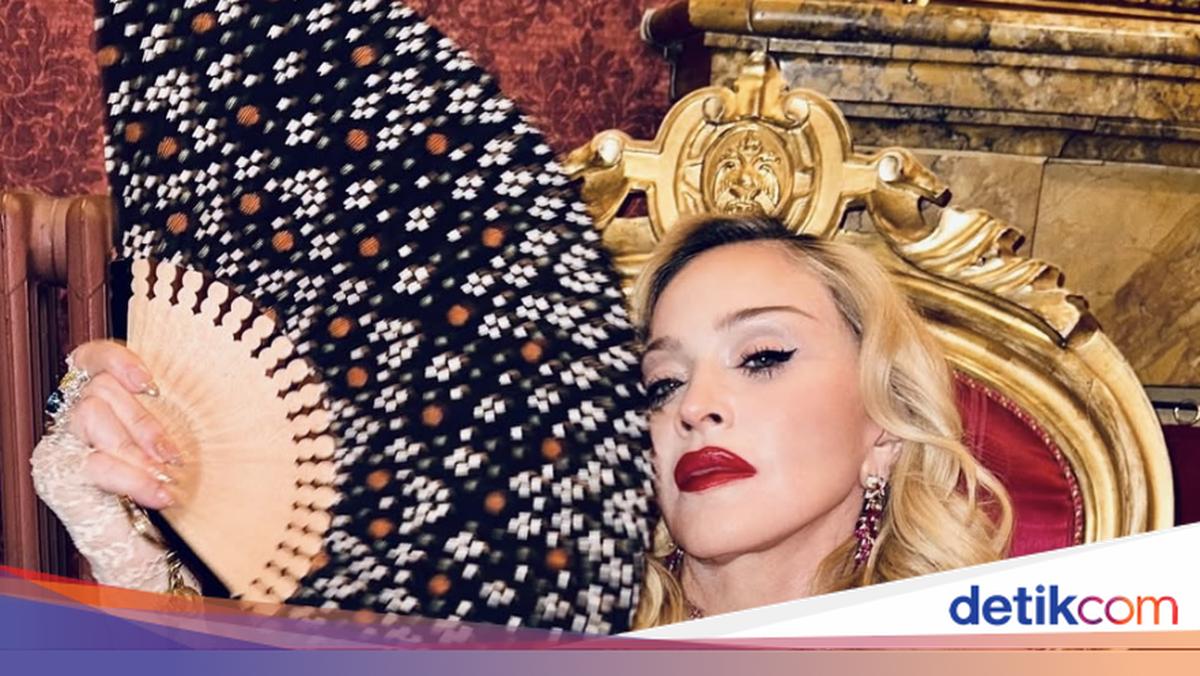 Madonna Rayakan Usia 67, Pilih Prosedur Kecantikan Baru yang Mengejutkan