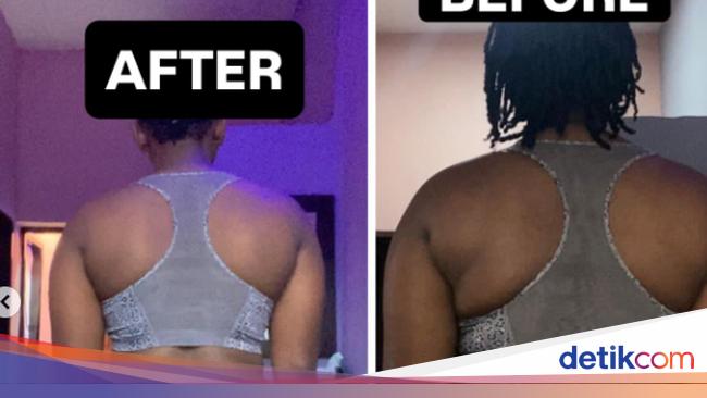 Turun 25 Kg dalam 4 Bulan, Wanita Ini Buktikan Diet Tak Harus Menyiksa