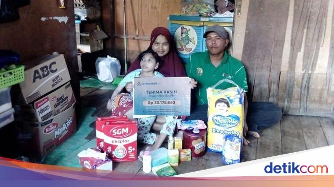 Sahabat Baik Bantu Kebutuhan April, Anak Tukang Becak Penderita Mikrosepalus