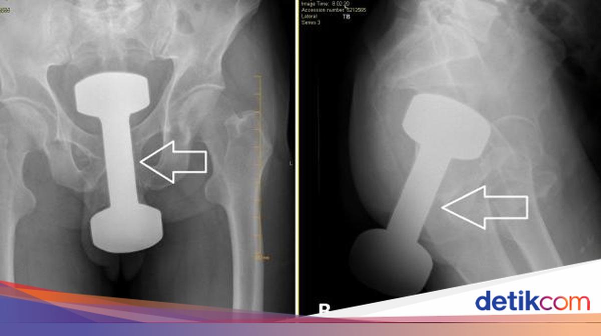 Yalangoch paypoqlarda yalangoch fohishalar