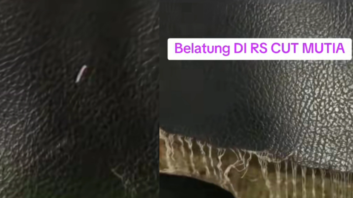 Viral Bed Pasien di RSUD Cut Meutia Penuh Belatung, Kemenkes Angkat Bicara