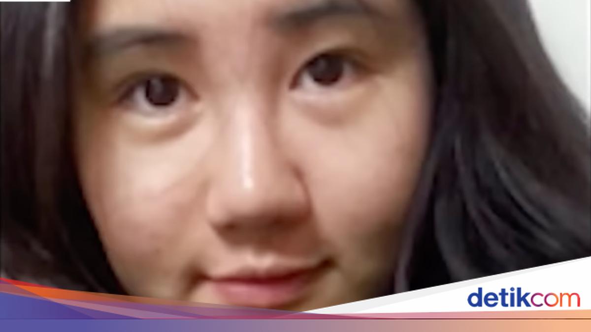 Viral Wanita 400 Kali Oplas Habiskan Rp 3,8 Miliar, Begini Wajahnya Sekarang