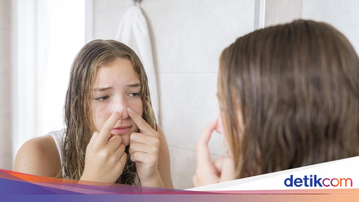 7 Penyebab Jerawat di Hidung dan Cara Mengatasinya