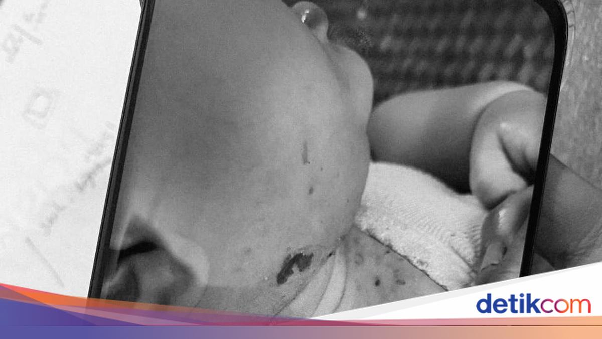 Polisi Tempuh Perjalanan 14 Jam Usai Ada Info Bayi Sakit Pascabencana Aceh Tengah