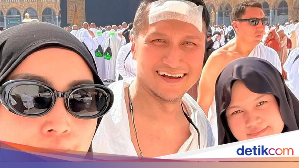 Arie Untung Alami Kepala Bocor di Arab