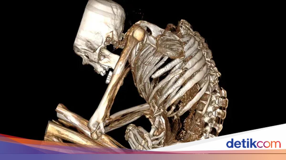 Ancient Mummy Death Mystery Solved: The Cause Revealed