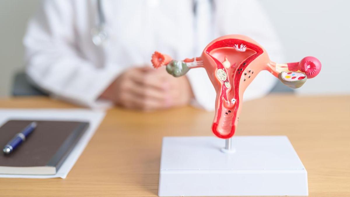 PCOS Berganti Nama Menjadi PMOS, Apa Bedanya? Ini Penjelasan Obgyn