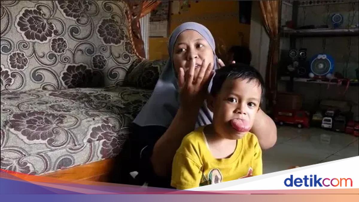 Cerita Febio, Bocah 6 Tahun yang Hidup dengan Tumor Lidah