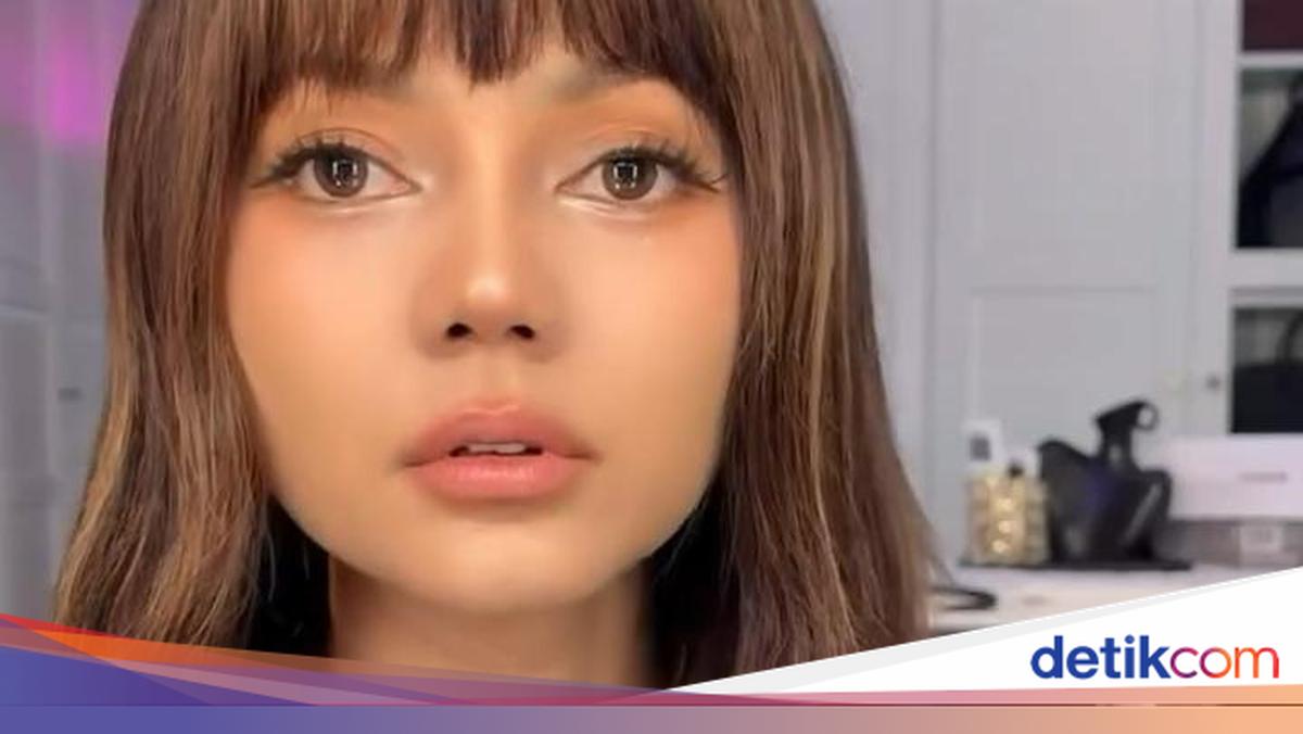 Penampilan Rina Nose Usai Oplas Hidung