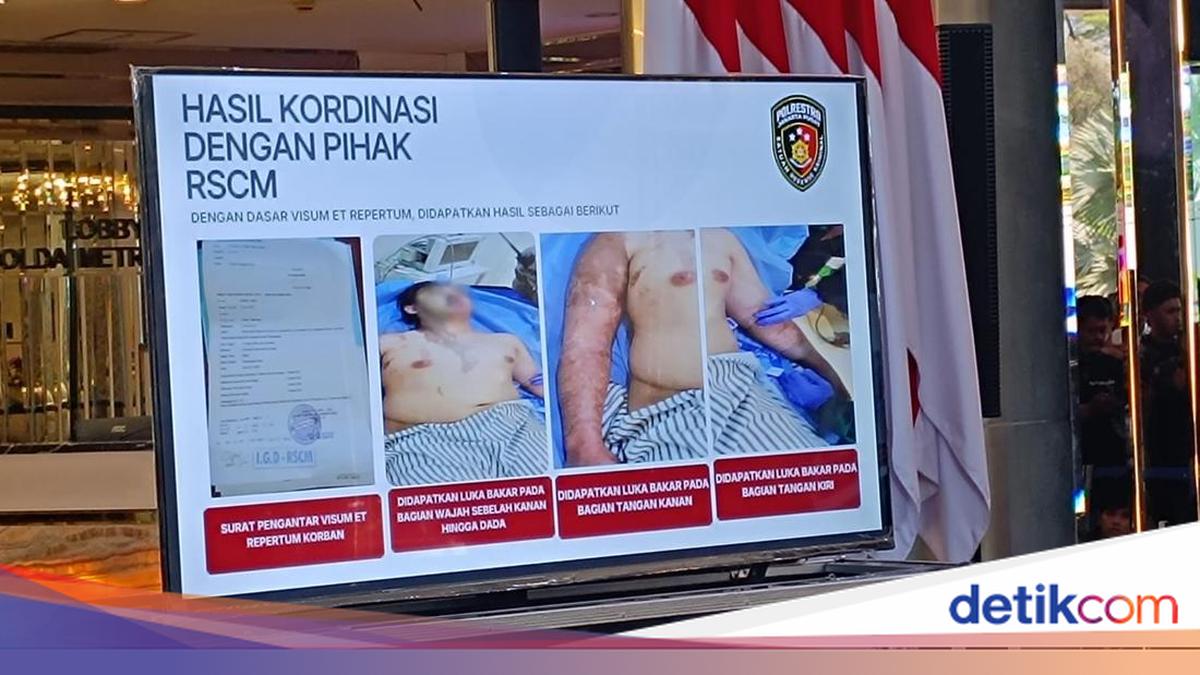 Komnas HAM Pakai Istilah Zat Kimia Asam Kuat di Kasus Penyiraman Andrie Yunus