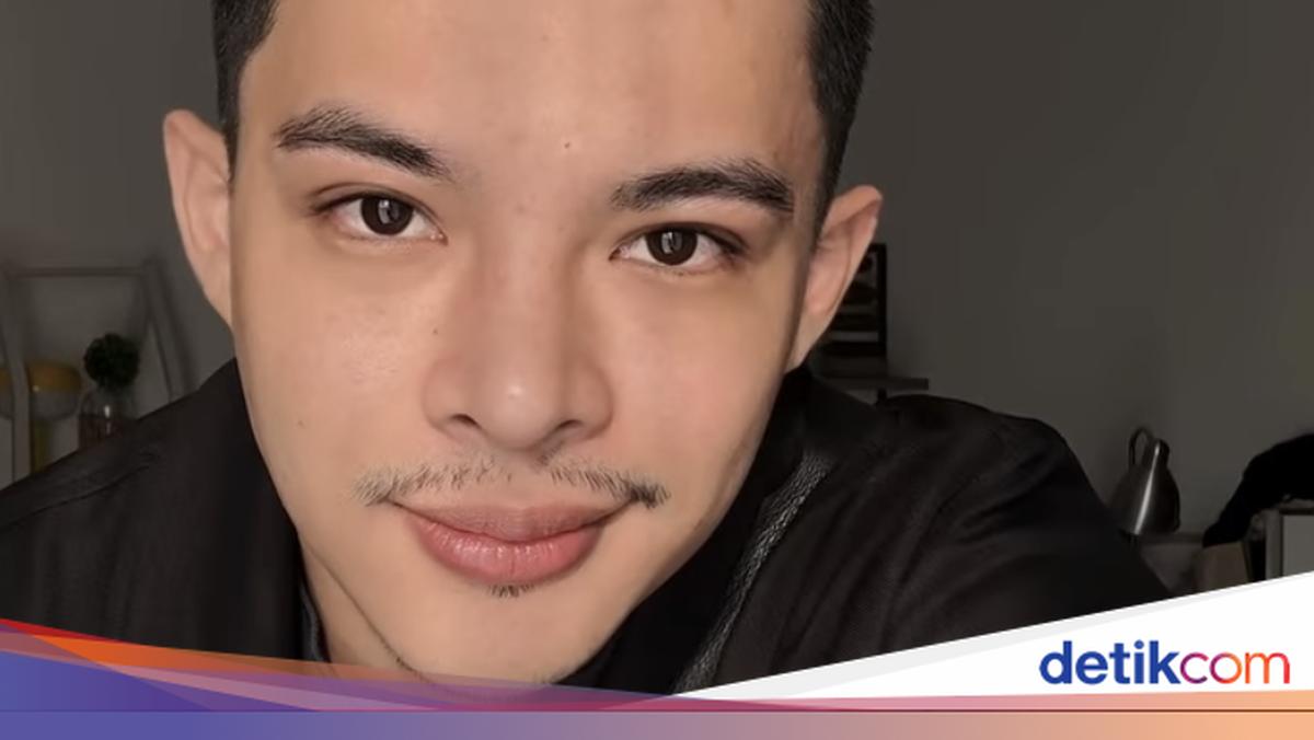 Rey Mbayang Idap Autoimun Psoriasis