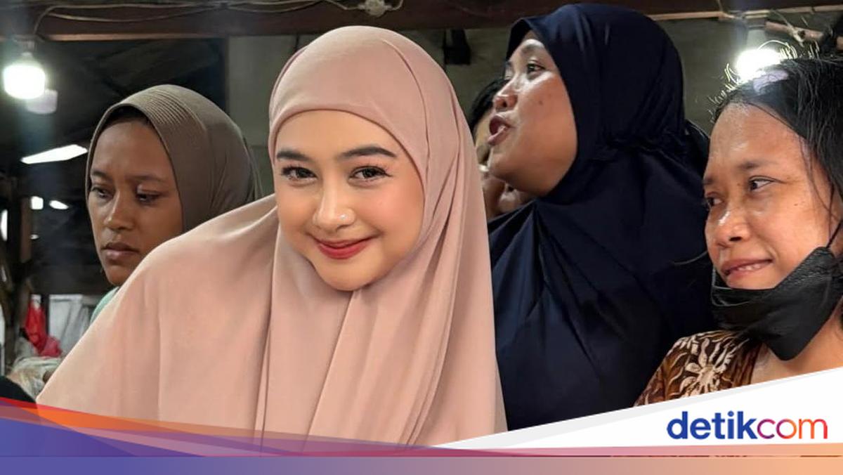 Ria Ricis Luruskan soal Operasi Hidung dan Wajah Berubah