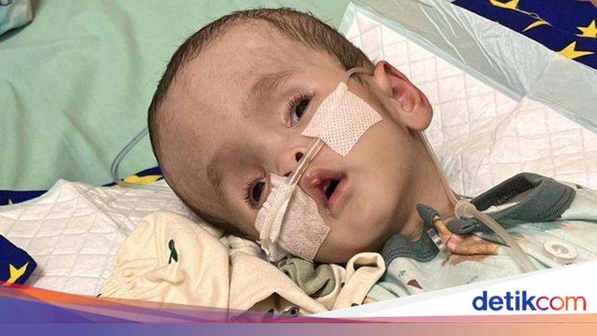 Kisah Anugerah, Bayi 6 Bulan Penderita Hidrosefalus yang Berjuang Sembuh