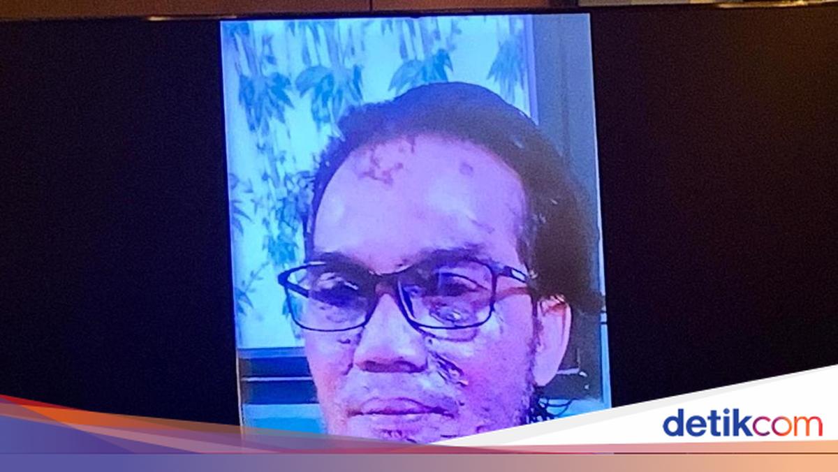 Foto Luka Wajah Terdakwa Penyiram Air Keras ke Andrie Yunus Ditampilkan di Sidang