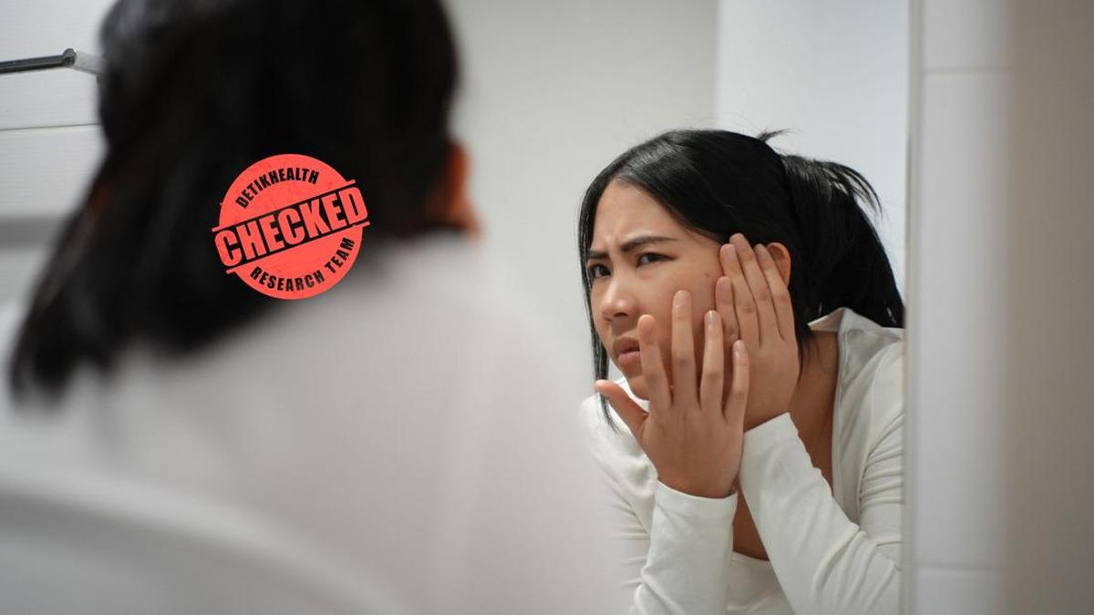 Rajin Cuci Muka Kok Tetap Jerawatan? Awas, Pola Makan Seperti Ini Bisa Jadi Pemicu