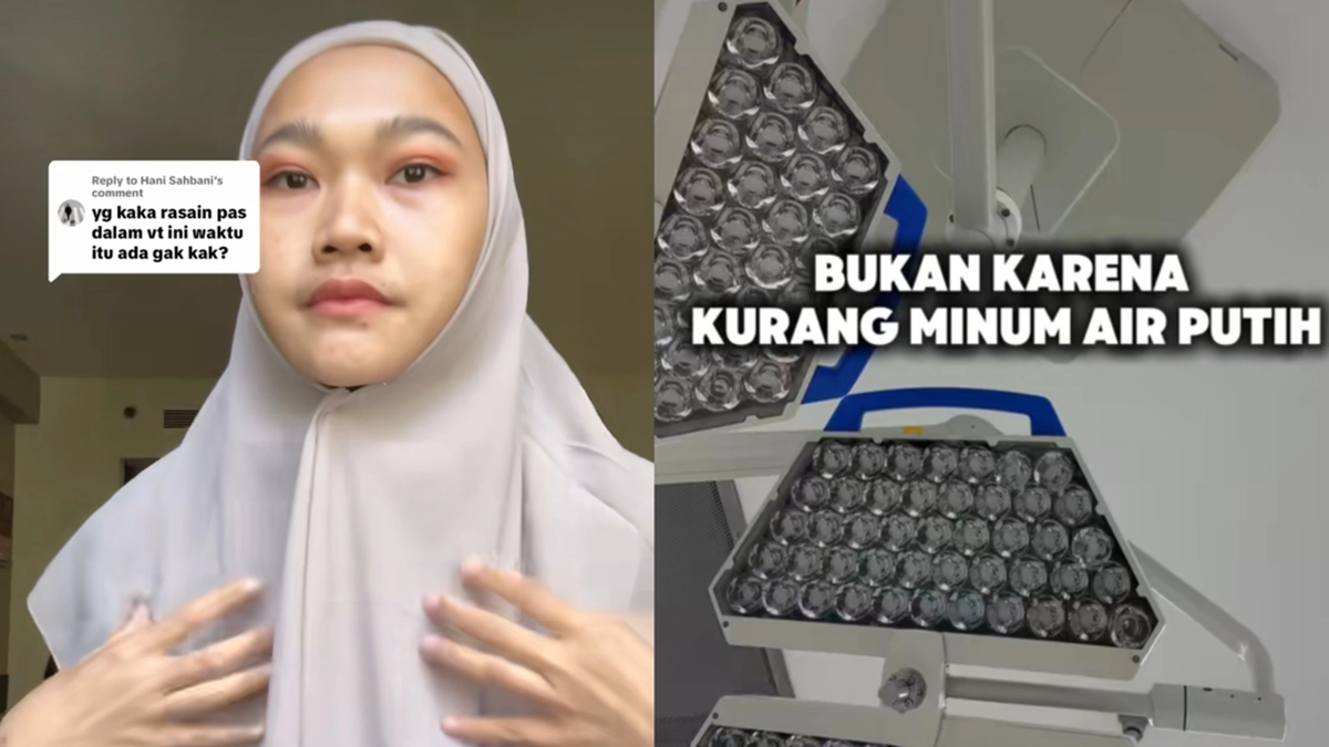 Viral Wanita Bekasi Disebut Dokter Punya Wajah Khas Gagal Ginjal, Apa Ciri-cirinya?