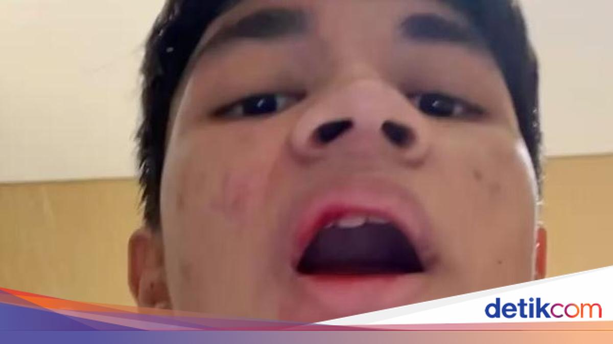 Muzakki Ramdhan Alami Kekerasan oleh Orang Tak Dikenal: Bibir Berdarah